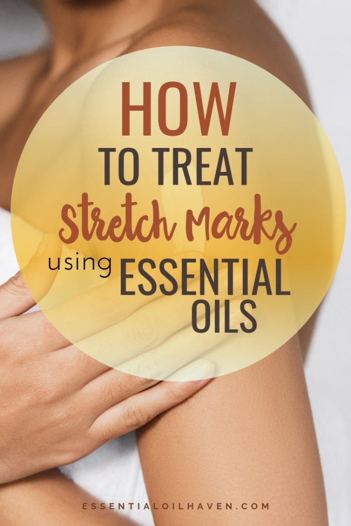 treating stretch marks with essential oils
