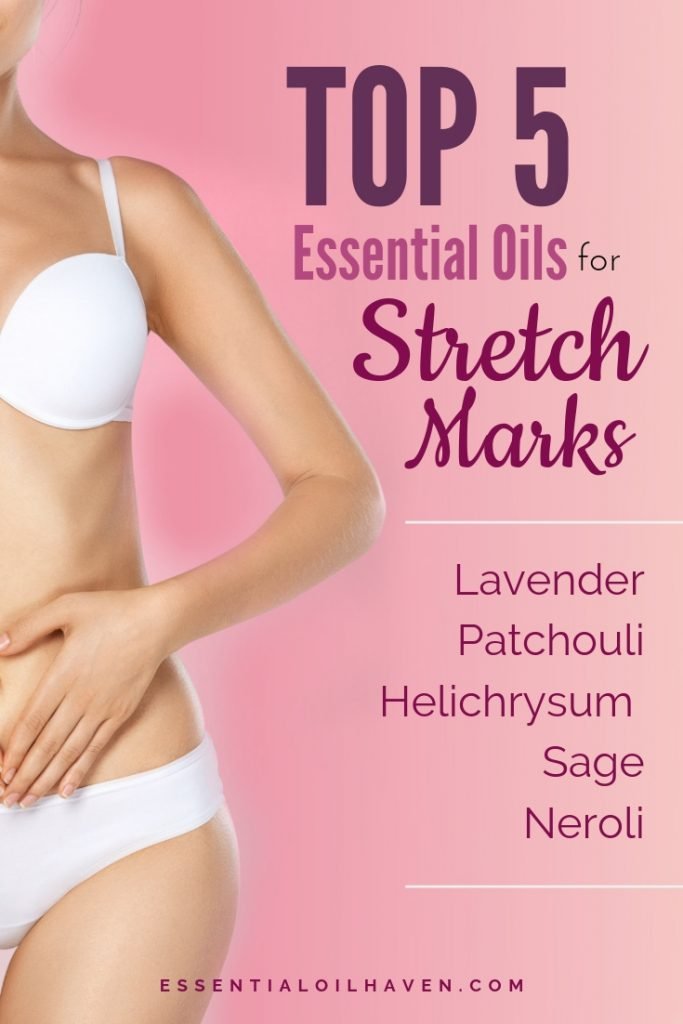 best essential oils for stretch marks